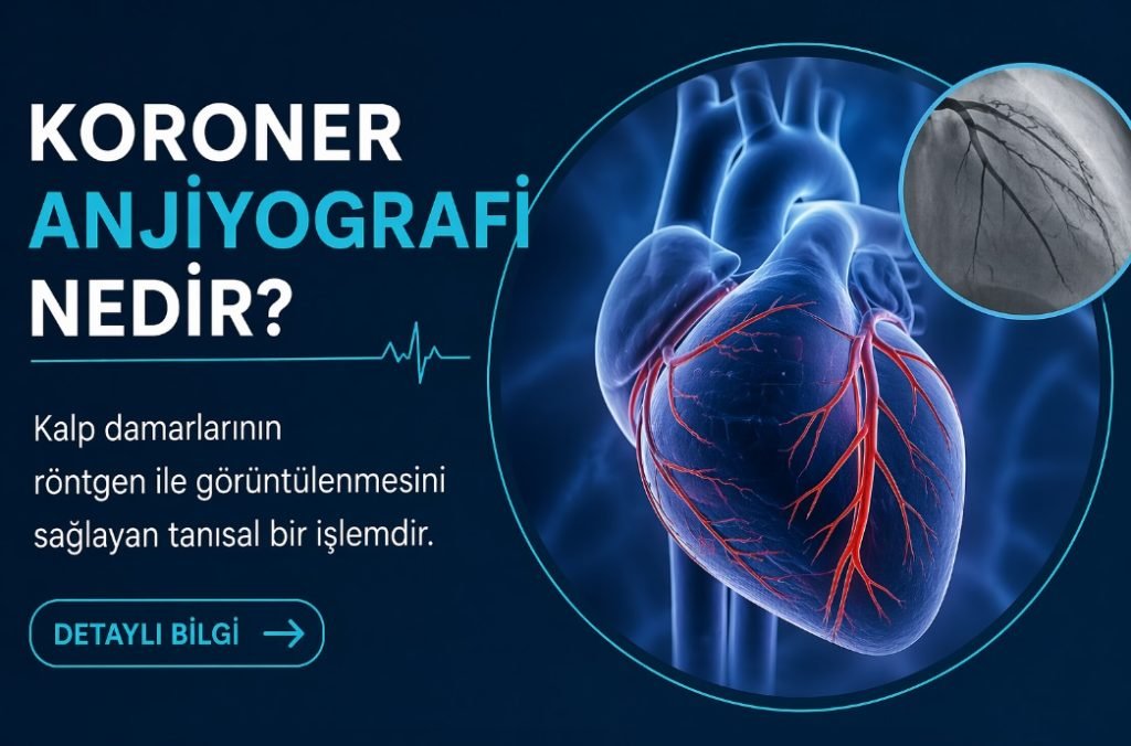 Koroner Anjiyografi