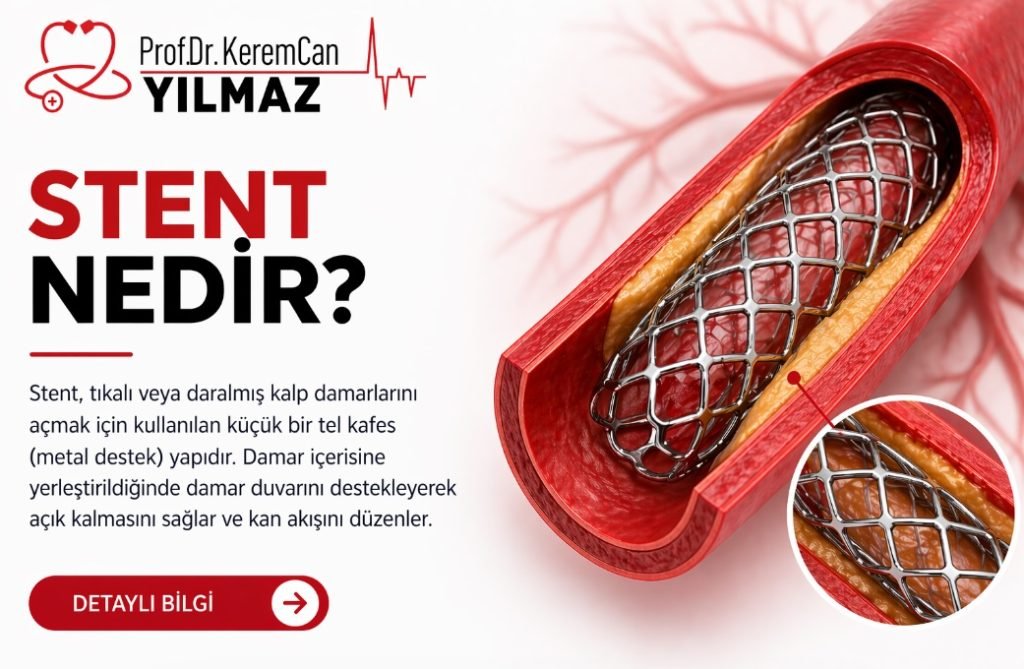 Supraventriküler Taşikardi